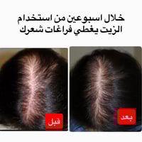 علبتين +علبه مجانا من زيت الجدايل 200مل