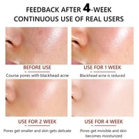سيروم VIBRANT GLAMOUR Pore Minimizer لتقليص المسام...