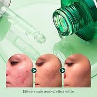 مجموعة شجرة الشاي للعناية بالبشرة كريم عين+ سيروم+...