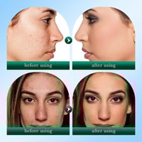 مجموعة شجرة الشاي للعناية بالبشرة كريم عين+ سيروم+...