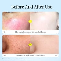 قناع البابونج المهدئ، قناع جل مرطب للوجه مع حمض ال...