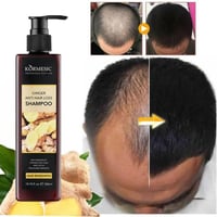 باكج منع تساقط الشعر