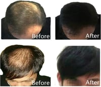 ديكسي الياف تكثيف بناء الشعر للرجال والنساء، اسود،...