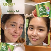 الكولاجين الفواكة الخضراء - Jellys Thailand Pro vi...