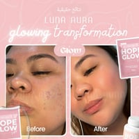 كبسولات هوب قلو المطور - Luna Aura Hope Glow Skin...