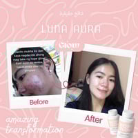 كبسولات هوب قلو المطور - Luna Aura Hope Glow Skin...