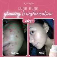 كبسولات هوب قلو المطور - Luna Aura Hope Glow Skin...
