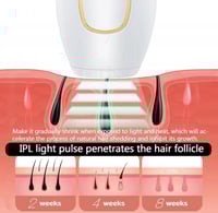 ليزر IPL ( وردي )