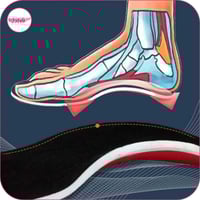 بطانة تصحيح القدم فلات فوت قطعتين