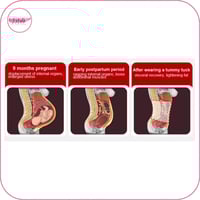 مشد مابعد الولادة المطور من قطعتين