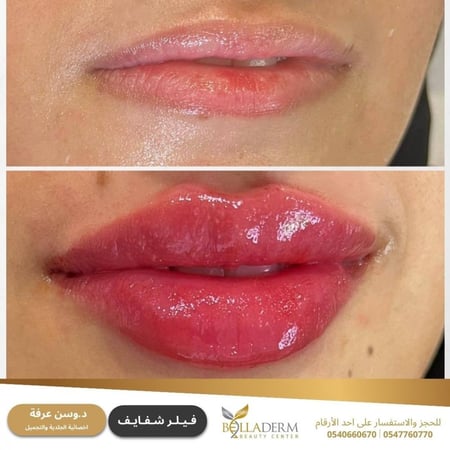 حجز استشارة مع  د.وسن عرفة