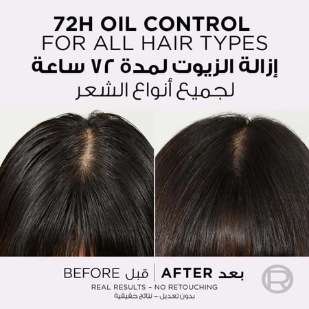 L'Oreal Paris شامبو إلفيف هيالورون بيور من لوريال باريس 400 مل