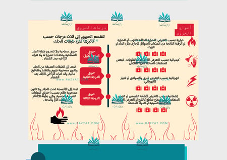 مطوية الحروق