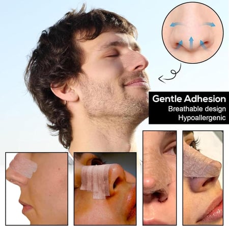 شريط لاصق جراحي 3M مايكروبور بلون بيج، لا يسبب الحساسية للاستخدام للبشرة