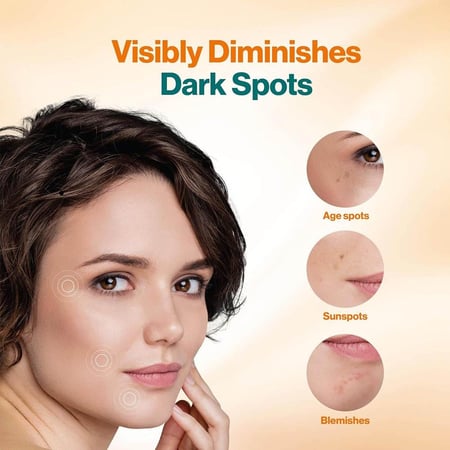 هيمالايا غسول الوجه بالكركم لإزالة البقع الداكنة - 100 مل