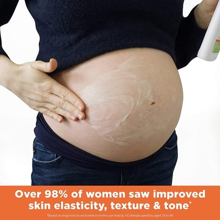 بالمرز لوشن لعلامات تمدد الجلد - 250 مل