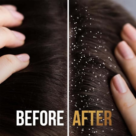 بانتين شامبو برو-في ضد القشرة 2 في 1 - 390 مل