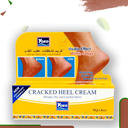 كريم تشققات القدمين (اليوكو)cracked heel cream