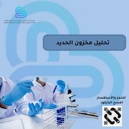 تحليل مخزون حديد