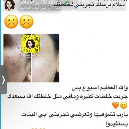 خلطه رقم 1 للبشره الدهنية