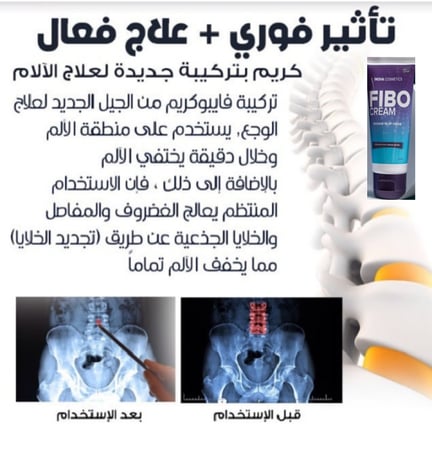 كريم فيبو للمفاصل