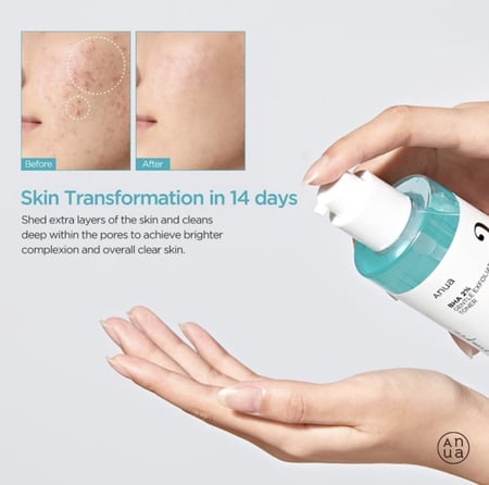 Anua - BHA 2% Gentle Exfoliating Toner 150ml  تونر تقشير لطيف يحتوي على BHA
