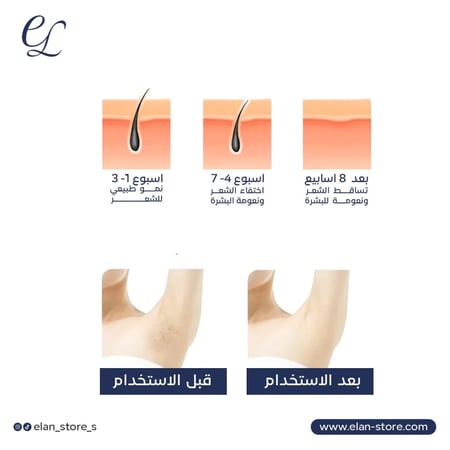 جهاز إزالة الشعر IPL المنزلي