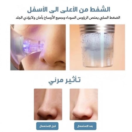 جهاز تنظيف الوجه - هامة