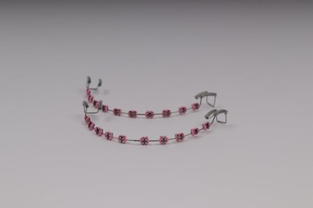 تقويم اسنان بدون غرا (فكين)