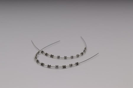 تقويم اسنان بغرا (فكين)