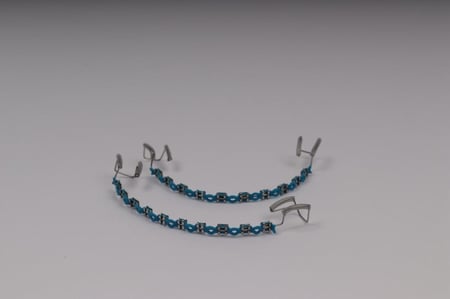 تقويم اسنان بدون (غرا فكين)