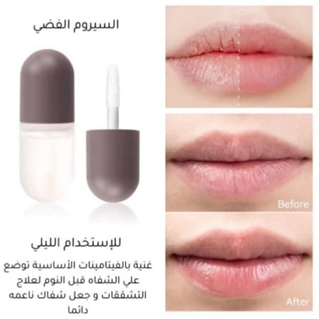 قلوس تكبير الشفايف