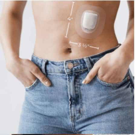 لاصق شفافا fixic اوميني بود