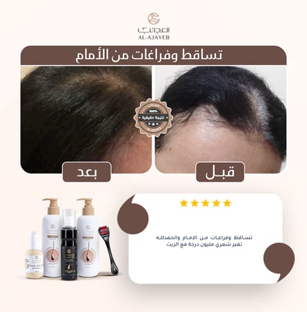 زيت الأعشاب السبعة (عبوتين)