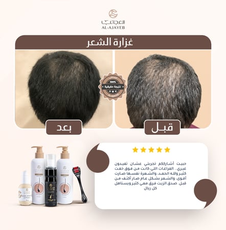 زيت الأعشاب السبعة (عبوتين)