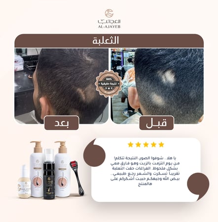 زيت الأعشاب السبعة