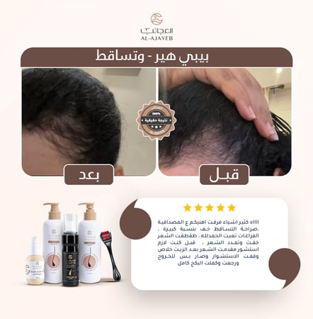 زيت الأعشاب السبعة