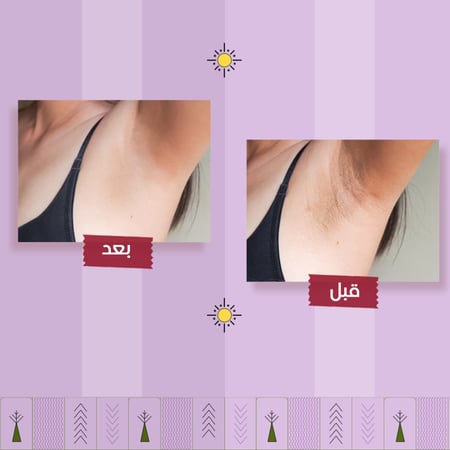 مزيل عرق حماية طبيعية للرجال والسيدات