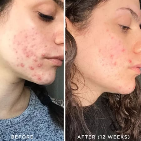 جهاز التردد العالي لمعالجة الحبوب