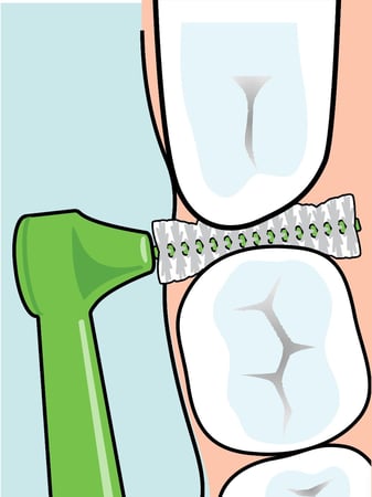 فرش مابين الأسنان مائلة ناعمة ANGLE PINK BLISTER