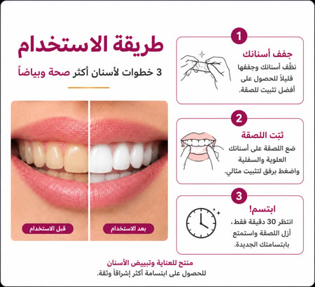 لاصق تبييض الاسنان ريفايل