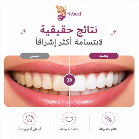 لاصق تبييض الاسنان ريفايل