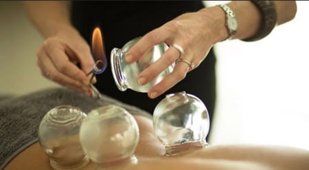 مساج كاسات الهواء ما يسمي بالحجامة الجافة علاج آلام الظهر والابهر