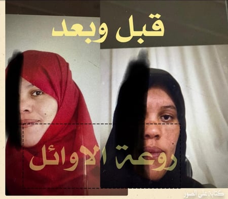 كريم عرق السوس من نورفينا لتفتيح البشرة وتوحيد اللون