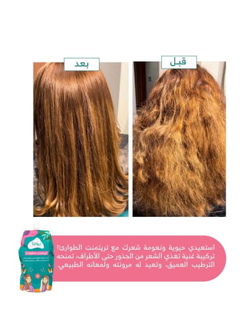 تريتمنت ماسك الطوارئ|بديل الصالونات