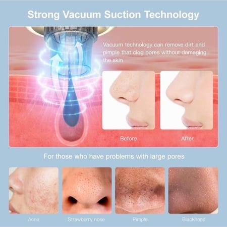 جهاز تنظيف البشرة