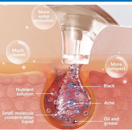 جهاز تنظيف البشرة