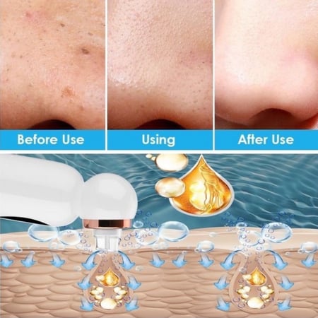 جهاز تنظيف البشرة