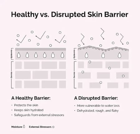 The Ordinary Soothing & Barrier Support Serum