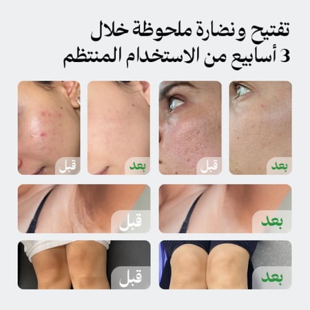 مجموعة لونيل